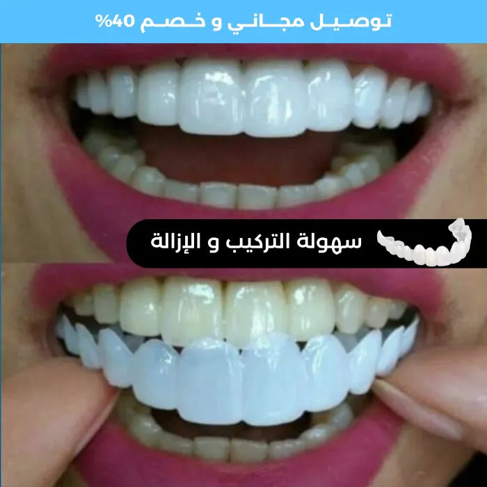 ابتسامة هوليود متحركة